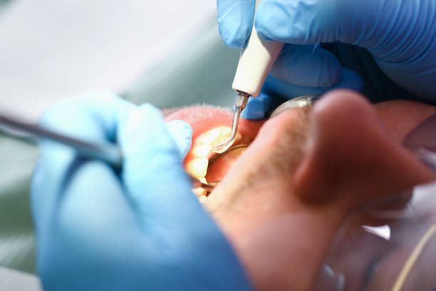 Best After-Hours Emergency Dentist in Fox Lake Hls, IL